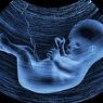 Ultrasound  - 